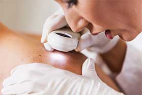Basal Cell Carcinoma Treatment Los Angeles, CA