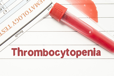 Thrombocytopenia treatment in Dallas, TX